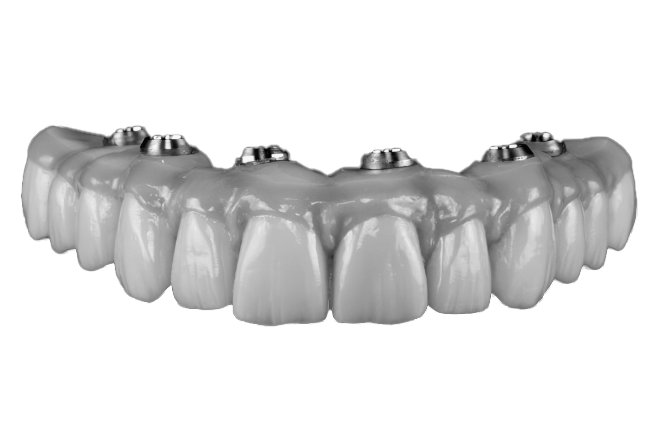 all-on-6 adent jaw