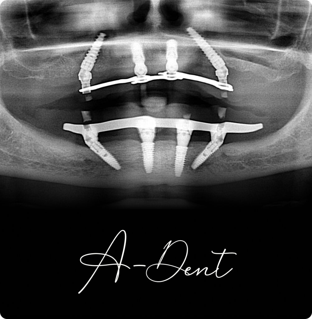 adent portfolio case