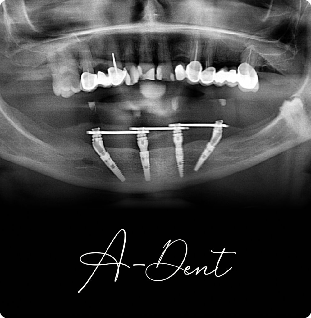 adent portfolio case