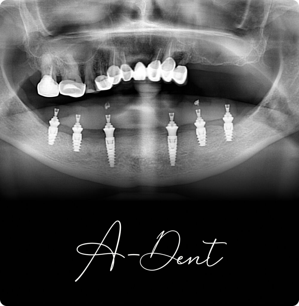 adent portfolio case