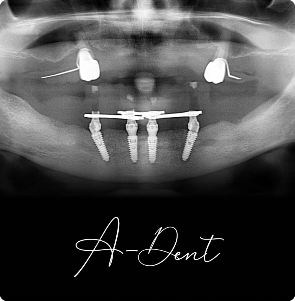 adent portfolio case