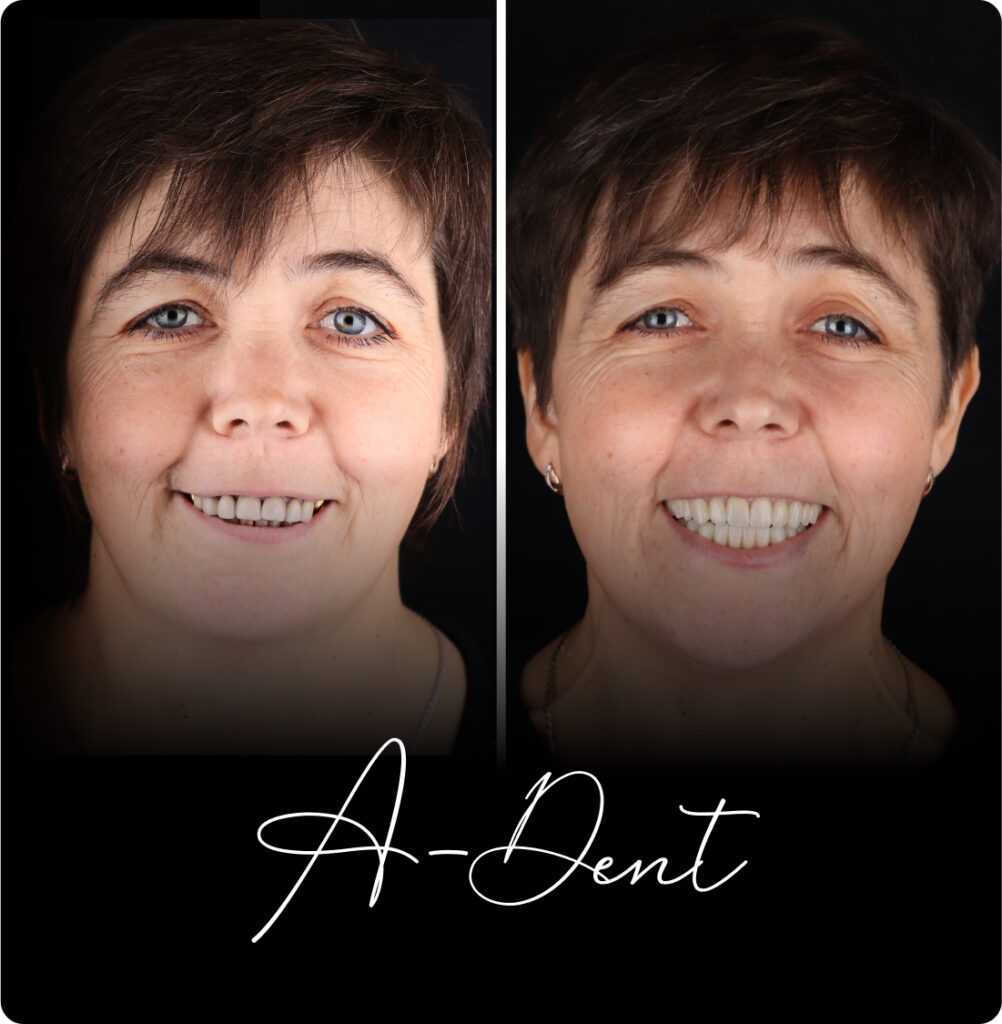 adent portfolio case