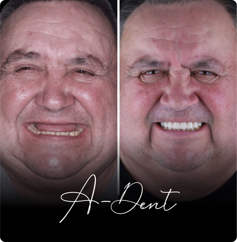 adent portfolio case