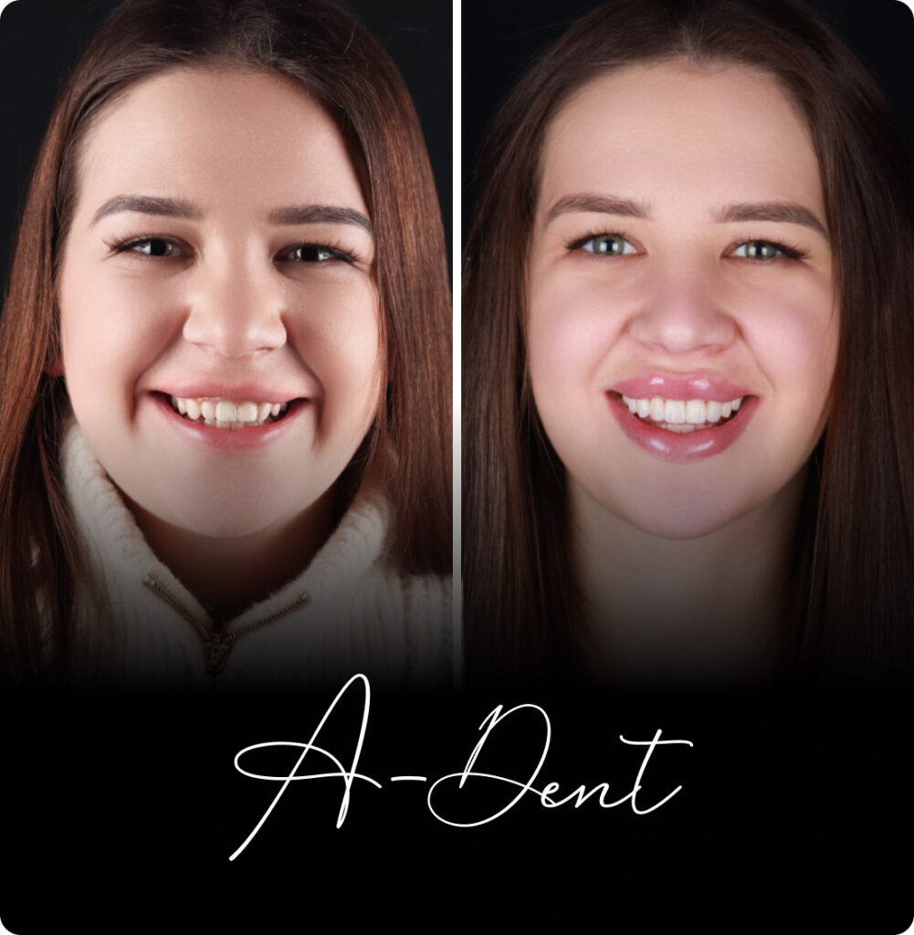 adent portfolio case