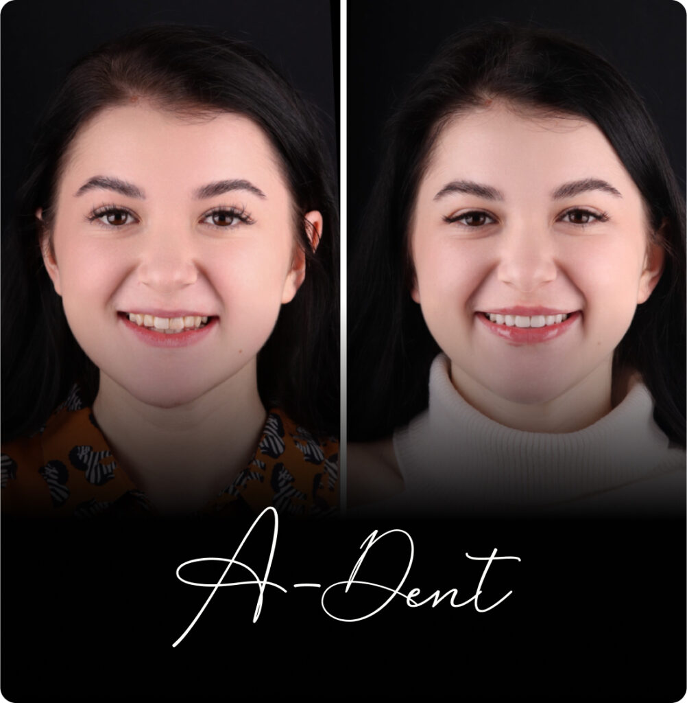 adent portfolio case